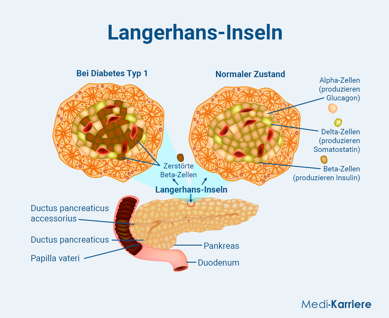 Langerhans Inseln.Grafik