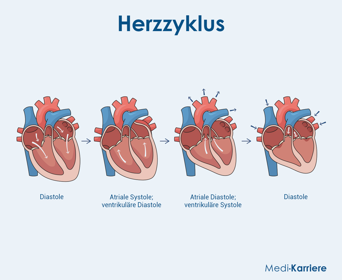 Ventilebenenmechanismus Grafik